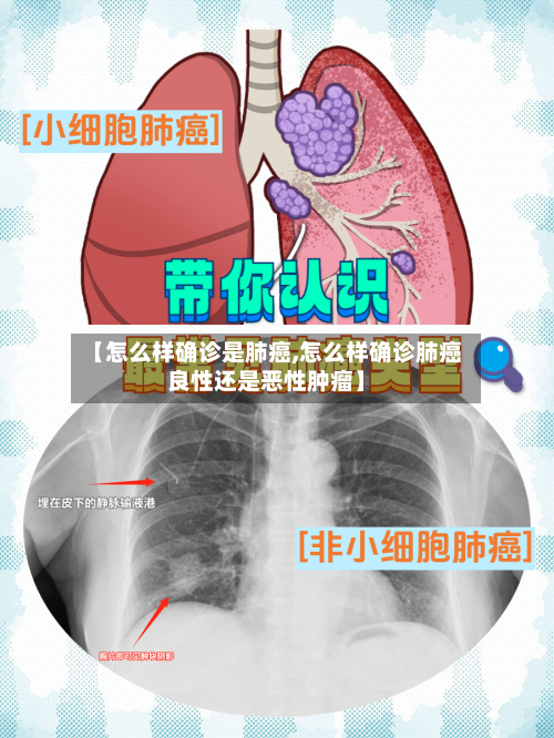 【怎么样确诊是肺癌,怎么样确诊肺癌良性还是恶性肿瘤】