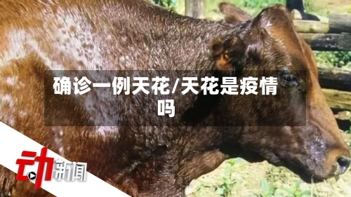 确诊一例天花/天花是疫情吗