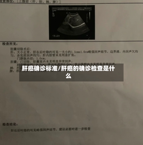 肝癌确诊标准/肝癌的确诊检查是什么-第2张图片