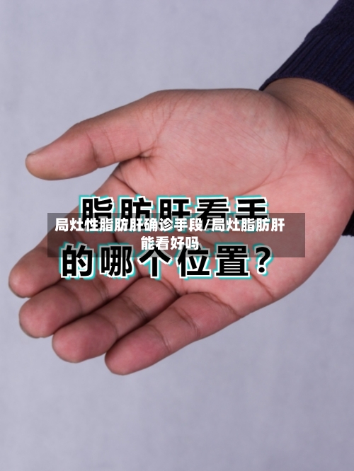 局灶性脂肪肝确诊手段/局灶脂肪肝能看好吗
