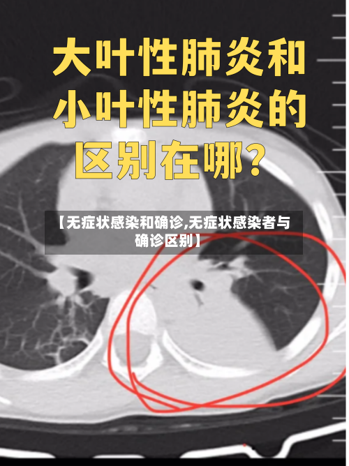 【无症状感染和确诊,无症状感染者与确诊区别】