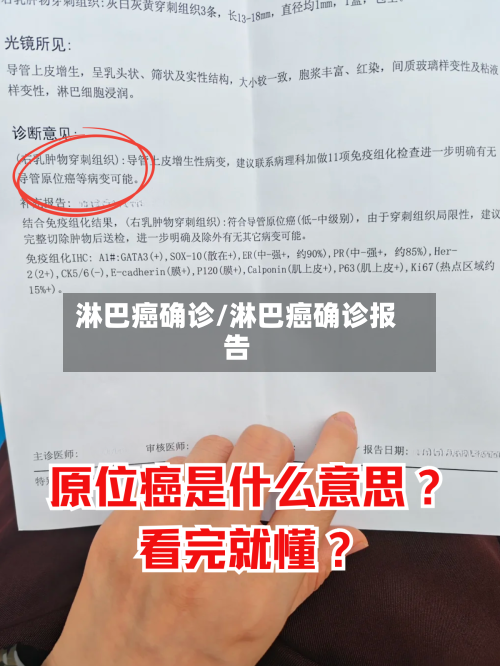淋巴癌确诊/淋巴癌确诊报告