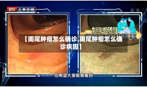 【阑尾肿瘤怎么确诊,阑尾肿瘤怎么确诊病因】-第3张图片